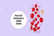 Association between red blood cell distribution width and the Prognosis of Brain Death in Patients with a Glasgow Coma Scale <6