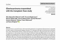 Choriocarcinoma transmitted with the transplant: Case Study